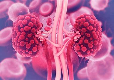 Conditions A Nephrologist Treats