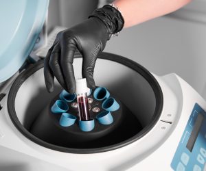 Plasmolifting process. Preparation of blood for injections. Cosmetologist in black rubber glove puts tube of blood in centrifuge. Concept of beauty and health